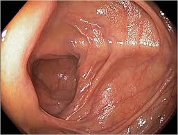 gastroenterologist in nashik